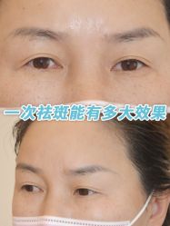 -清疣美疣·痣·斑净肤中心