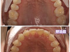 -同步齿科·数字化正畸种植口腔中心(珠海店)