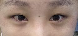 -八大处整形