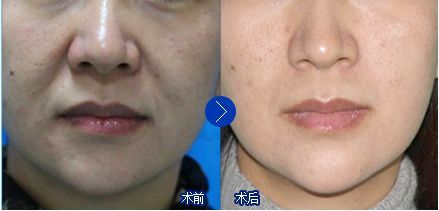 -SKINIST丽铂医疗美容