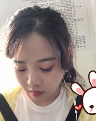 点击看大图 -大麦微针植发丨全国连锁