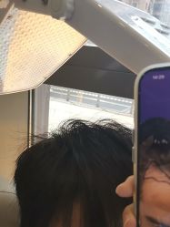 -碧莲盛·不剃发植发