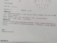 -成都神康癫痫医院