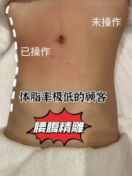 -Fundi张玉珊修身堂·indiba·BTL科技瘦身