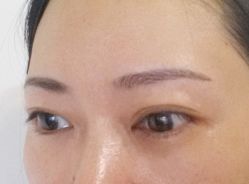 第十天，脱痂完毕，很自然-平萍纹绣韩式半永久定妆