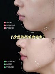 点击看大图 -YESIDO椰岛美容