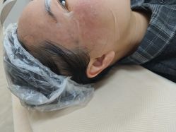 -长沙雅美医疗美容医院