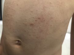 -春晖园度假酒店温泉