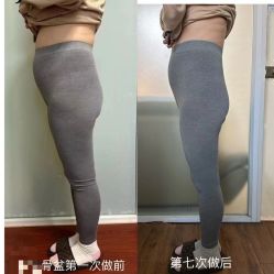 -产后帮产后修复(首城国际店)