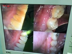 -咿呀口腔(光谷分院)