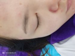 -蕾特恩专业祛痘国际连锁