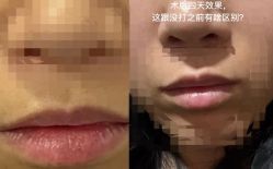 -美莱医学美容医院