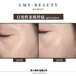 -丽美妍医疗美容·皮秒·立体分层抗衰