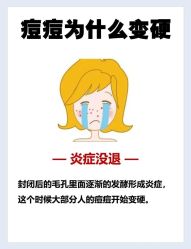 -BR光电保养