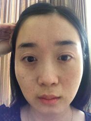 -成都西区医院整形美容
