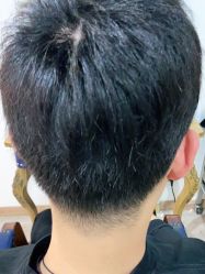 点击看大图 -极客侠男士假发定制补发