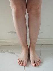 体验前-伊美尔医疗美容医院