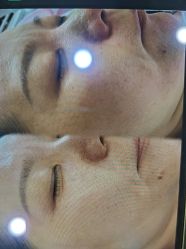 -郡艺医疗美容·微整·眼鼻吸脂