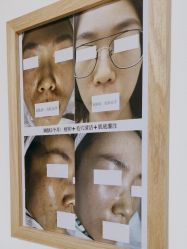 -美肤盾祛痘·问题肌头疗管理中心