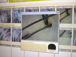-LESSMORE科技头皮理容中心
