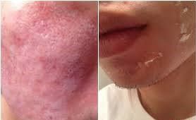 -SKINIST丽铂医疗美容