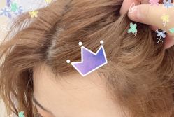 -大麦微针植发全国连锁