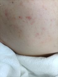 -蕾特恩专业祛痘·皮肤管理