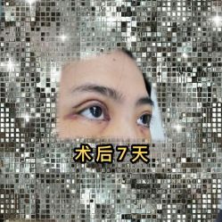 -南宁维密整形·王敦华眼鼻整复中心