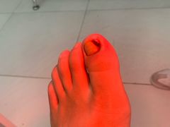 -新甲连锁灰指甲·甲沟炎·鸡眼(黑龙江路店)