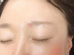 -德绣·机器野生眉发际线·美瞳线半永久