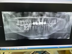 -土豆口腔(凤凰北总店)