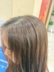 -碧莲盛·不剃发植发