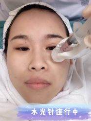 -新美荟医美·专注面部美学抗衰