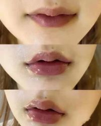 -上海漾颜医疗美容