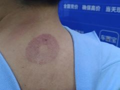 技师-裕和堂中医推拿艾灸(太古汇臻品店)