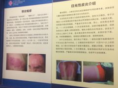 -杭州市第三人民医院