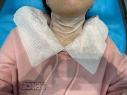 -agge蛋白医美