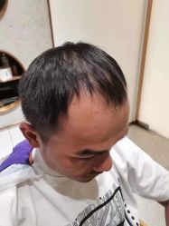 -发饰美男士增发补发假发定制店