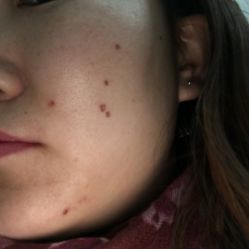 -空军总医院激光整形美容中心