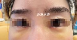 -天津伊美尔医疗整形美容专科医院