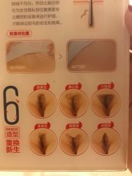 -咪咪比基尼脱毛专业店