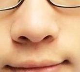 -成都苗方清颜专业祛痘