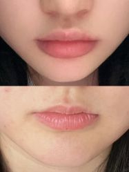 -上海伊莱美医疗美容医院