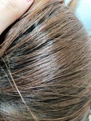 -熙朵美学植发·连锁品牌