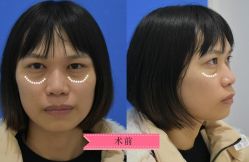 -广州健丽·去眼袋医疗美容机构
