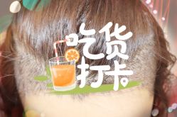 -大麦微针植发全国连锁