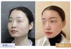 -圣嘉新医疗美容医院