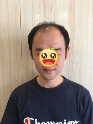 点击看大图 -极客侠男士假发定制补发