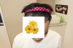 -大麦微针植发丨全国连锁