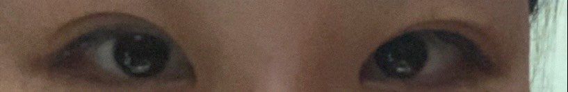 体验后-西美医疗美容门诊部